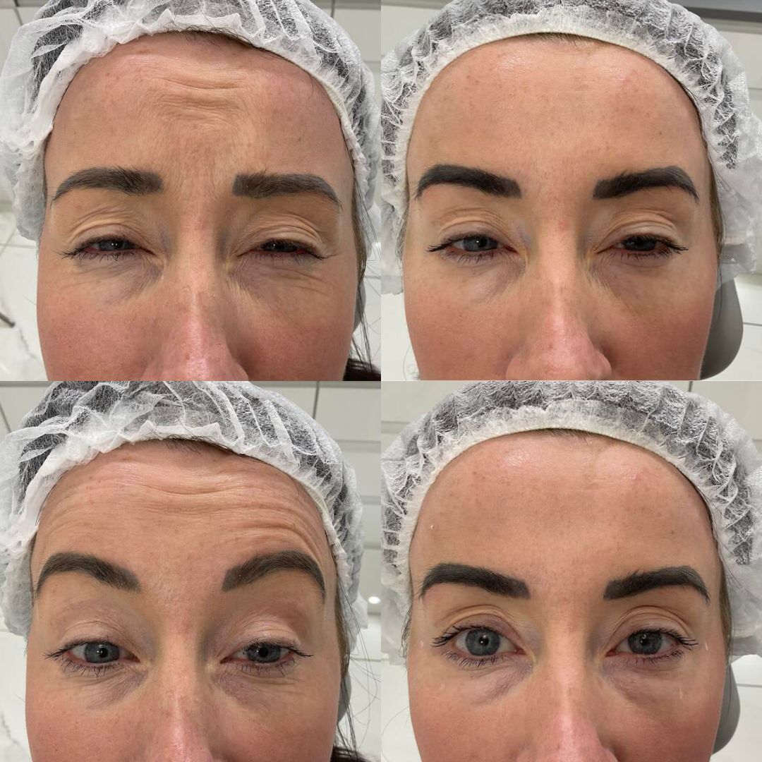 Anti-Wrinkle — Immaculate Makeup