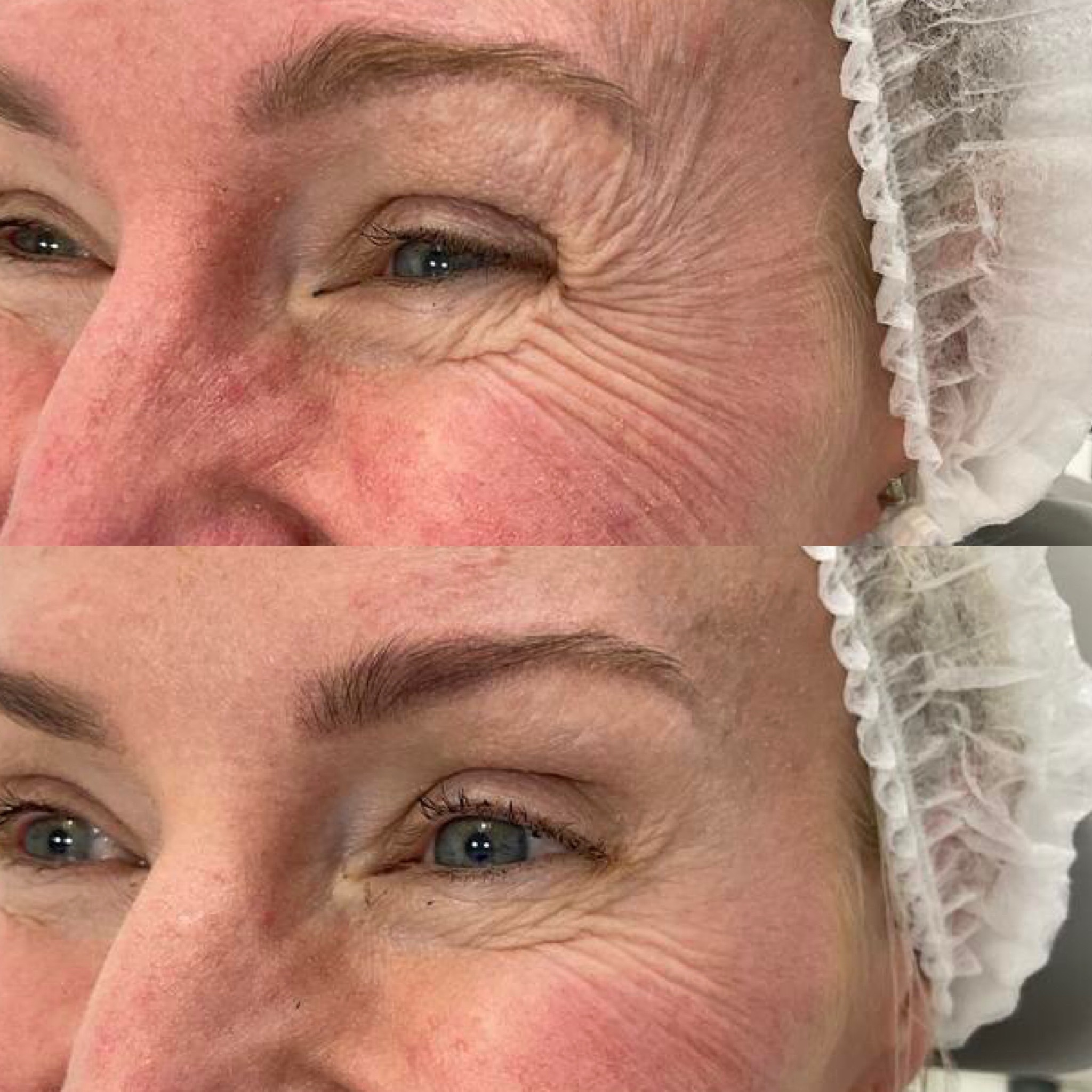 Anti-Wrinkle — Immaculate Makeup