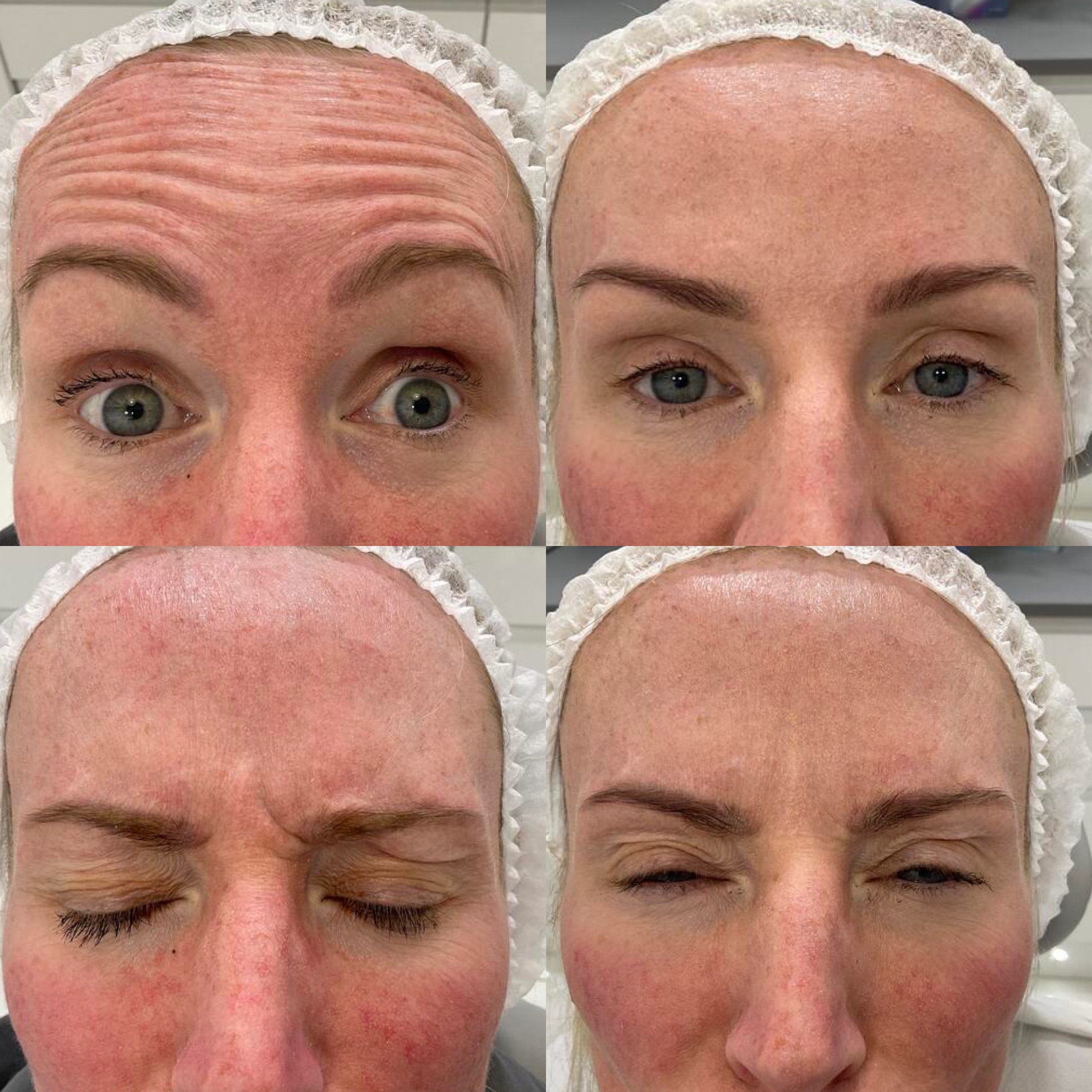 Anti-Wrinkle — Immaculate Makeup