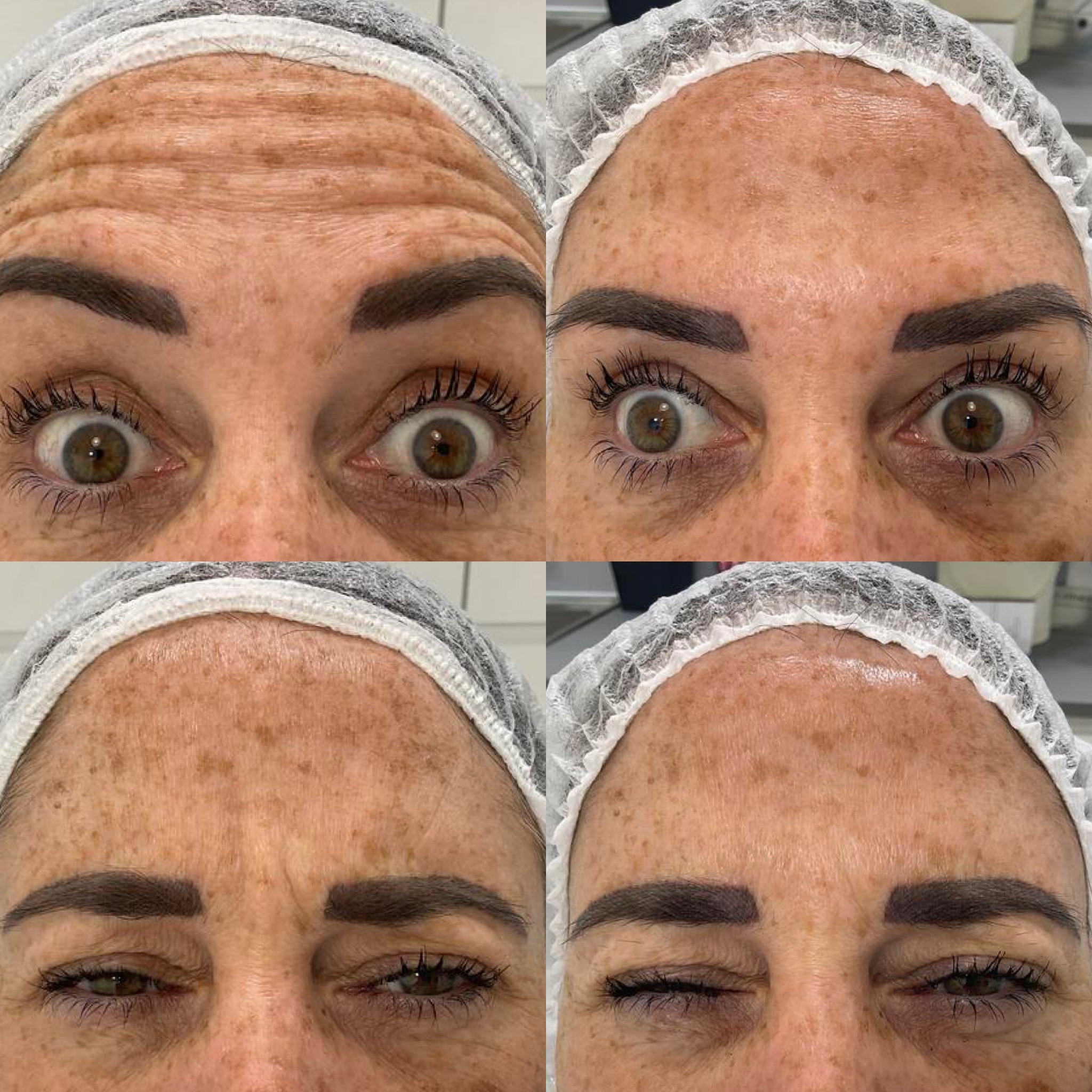 Anti-Wrinkle — Immaculate Makeup