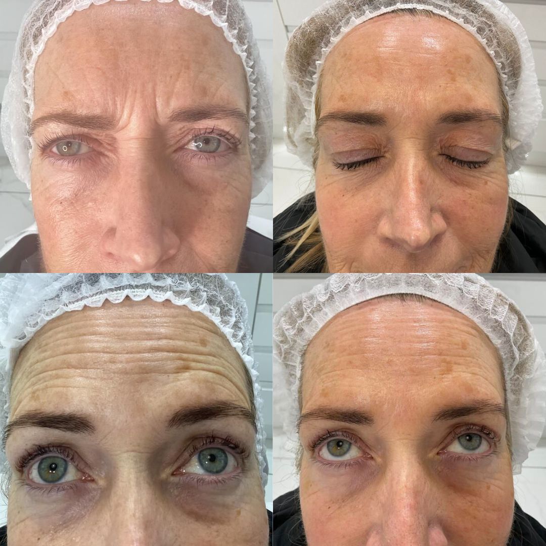 Anti-Wrinkle — Immaculate Makeup