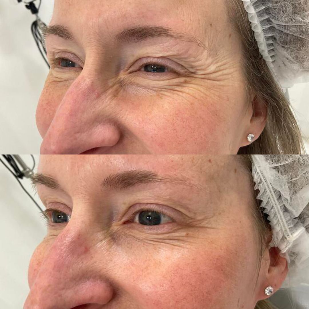 Anti-Wrinkle — Immaculate Makeup