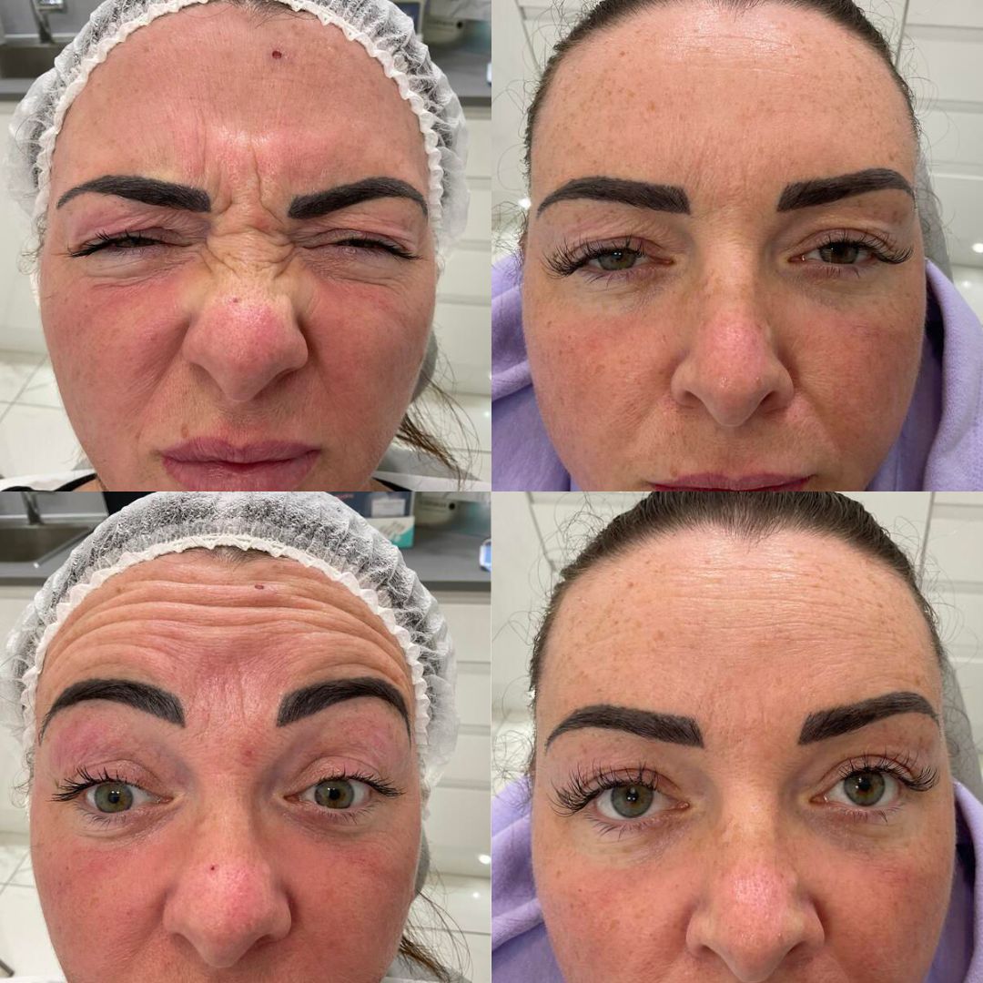 Anti-Wrinkle — Immaculate Makeup