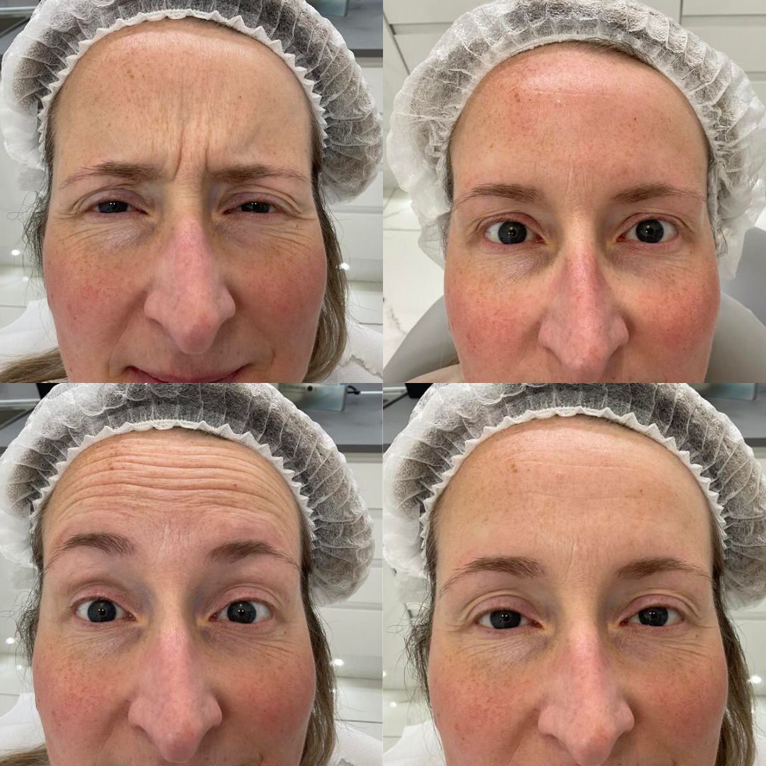 Anti-Wrinkle — Immaculate Makeup
