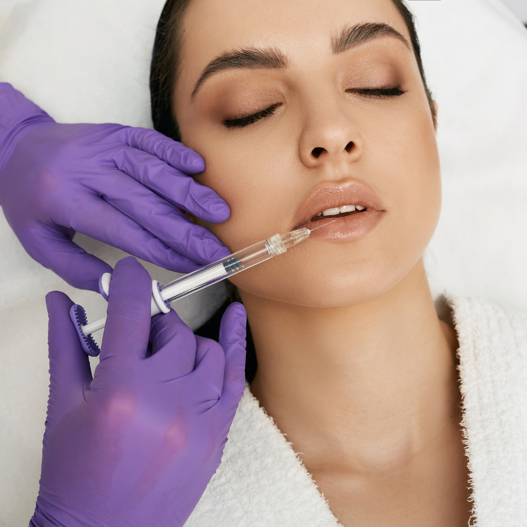 Dermal filler treatment