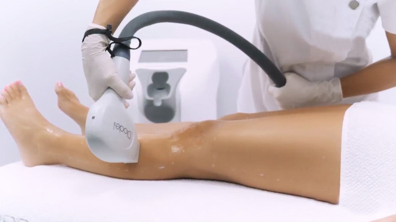 Primelase laser hair removal treatment at Immaculate Makeup